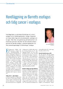 Handläggning av Barretts esofagus och tidig cancer i esofagus