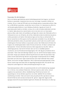 Pacemaker för ditt hjärtbarn