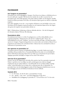 pacemaker - Vattenhallen - Lunds Tekniska Högskola
