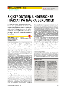 skiktröntgen undersöker hjärtat på några sekunder