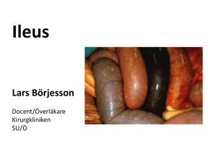 Ileus - Startsida vgregion.se