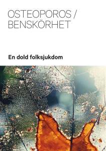 osteoporos / benskörhet