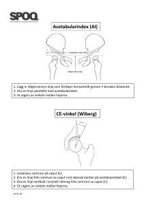 AI (Acetabular Index) och CE