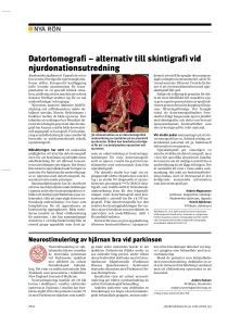 Datortomografi – alternativ till skintigrafi vid