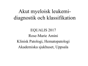 Akut lymfatisk leukemi
