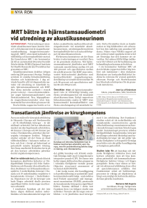 MRT bättre än hjärnstamsaudiometri vid utredning