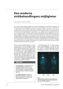 Den moderna strålbehandlingens möjligheter