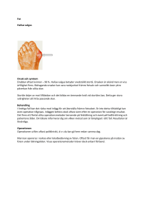 Fot Hallux valgus Orsak och symtom Drabbar oftast kvinnor – 90