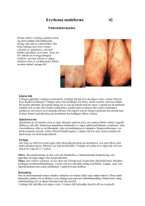 Erythema multiforme 42
