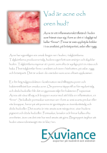 Att tänka på vid Exuviance behandlingar mot acne
