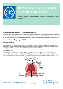 Barn med läpp-käk-gomspalt- en föräldrainformation