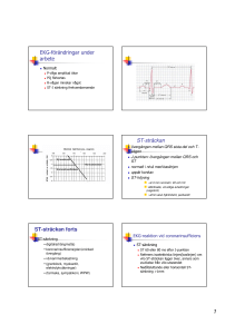 Arbetsprov och EKG-tolkning