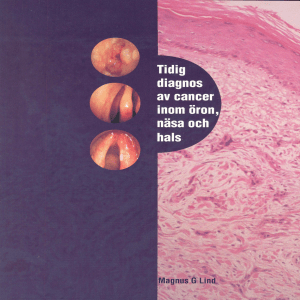 Tidig diagnos av cancer inom öron, näsa och hals